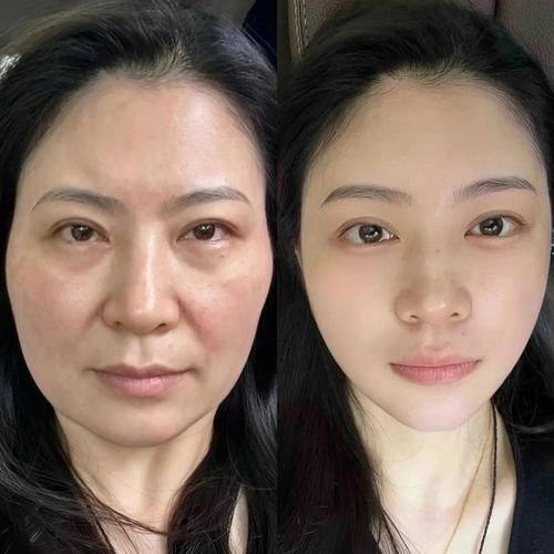 桂林容嫣医疗美容是正规医院吗?