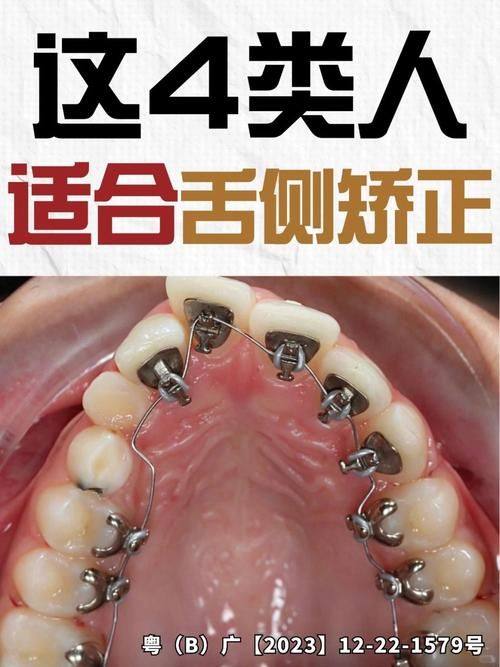 岳阳星齿健盖尔口腔门诊部详细的预约挂号方式及流程