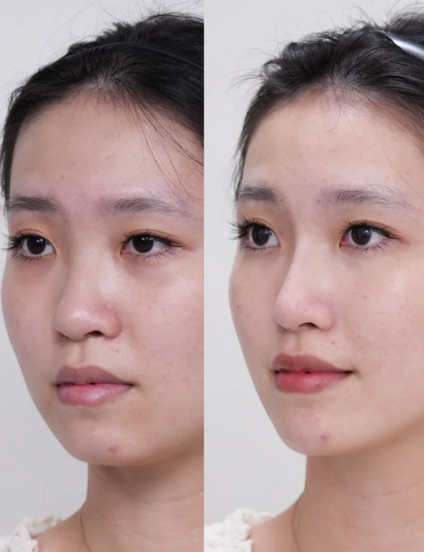 陶革方医生口碑评价及真人实例