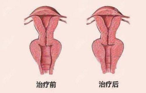 口碑评价及真人实例