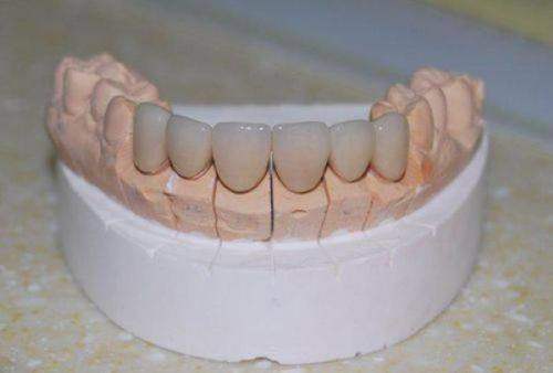 杭州口腔医院和睦门诊收费价格表（仅供参考）