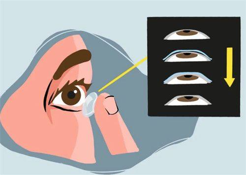 夏朝霞医生口碑评价及真人实例