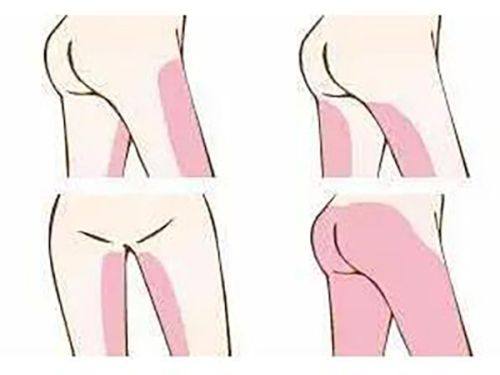 徐爱兵医生技术优势