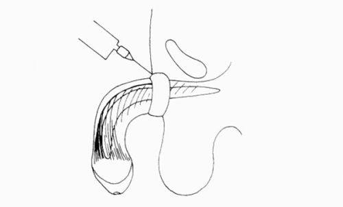 石红卫医生技术优势