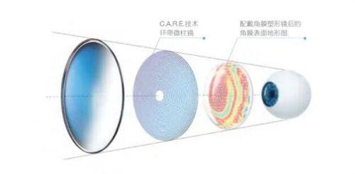 夏朝霞医生技术优势