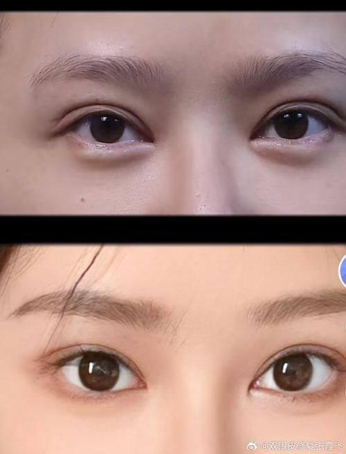 银川陈勇博士医疗美容医院收费价格表/收费标准