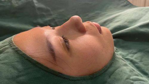 镁涵**医疗美容中 心真人口碑评价怎么样？