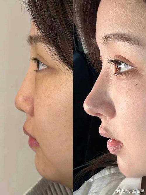 南京爱学菲庭整形医院详细的预约挂号方式及流程