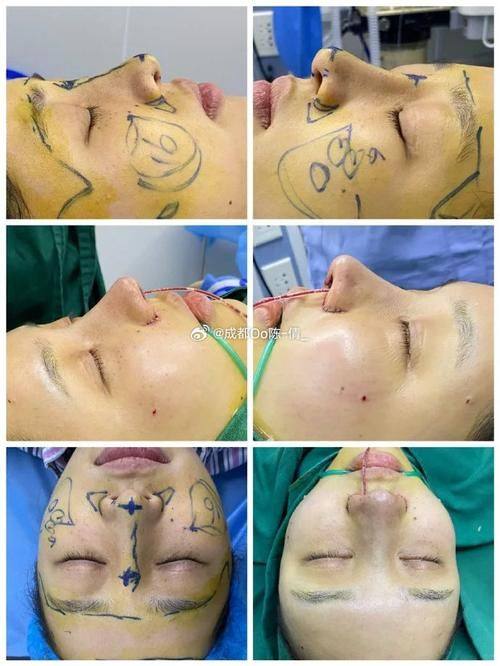 南京爱学菲庭整形医院是正规医院吗?