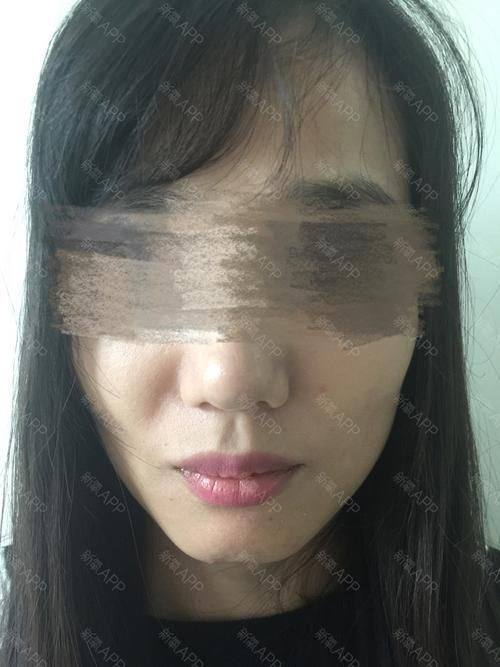 北京冰蝶医疗美容诊所真人口碑评价怎么样？