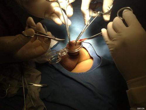 详细的预约挂号方式及流程