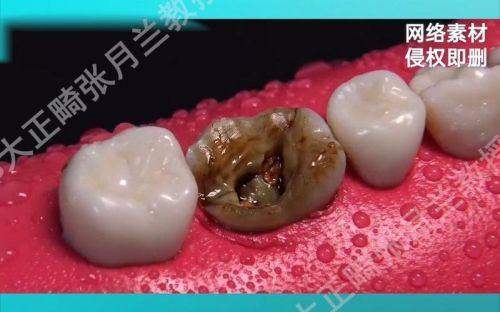 杭州口腔医院和睦门诊特色项目及技术优势