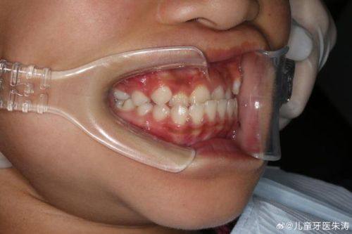 珠海铭钊口腔特色项目及技术优势