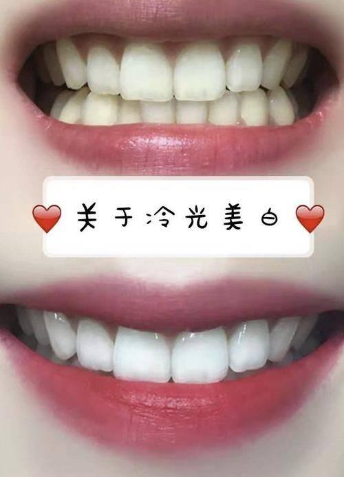 固芽口腔门诊部（高新店）收费价格表/收费标准