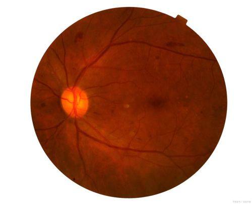 武汉市黄陂区人民医院眼科收费价格表/收费标准