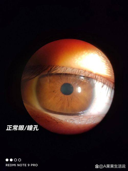 宁波市第六医院眼科医生团队实力强大及骨干医生简介