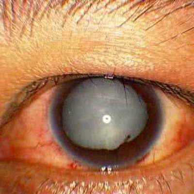 青岛眼科医院真人口碑评价怎么样？