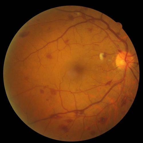 郑州麦迪格眼科诊所真人口碑评价怎么样？