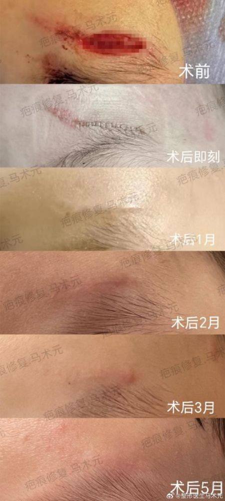 周口益健容妍整形医院收费价格表/收费标准