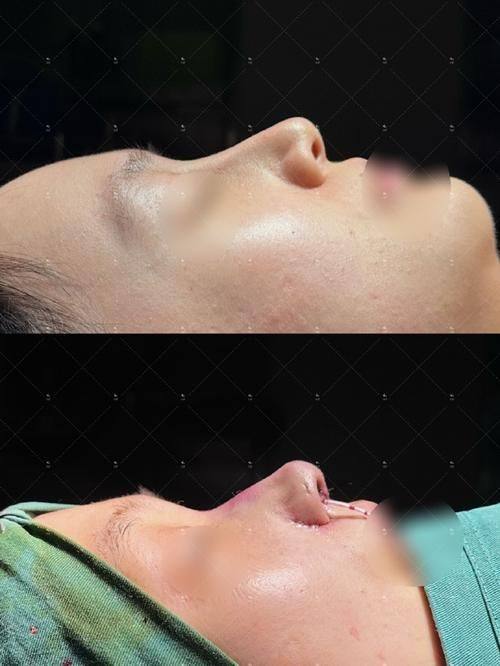 周口益健容妍整形医院真人口碑评价怎么样?