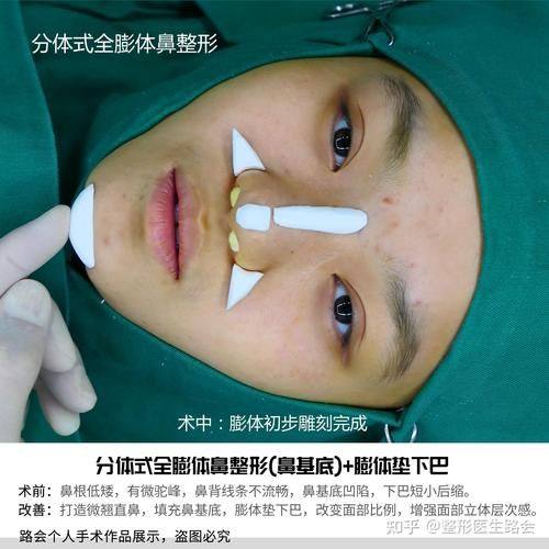 北京冰蝶医疗美容诊所收费价格表