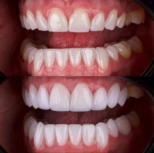 固芽口腔门诊部（高新店）特色项目及技术优势