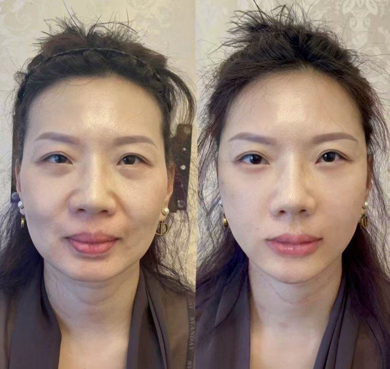 镁涵**医疗美容中 心医生团队实力强大及骨干医生简介