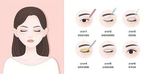 肖敬贞医生擅长项目