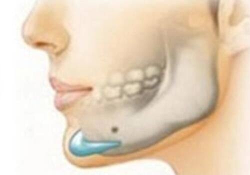 徐爱兵医生擅长项目