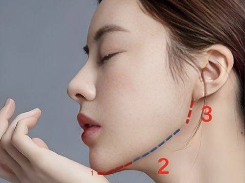 石红卫医生擅长项目