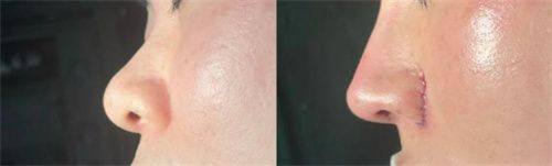 南宁伯克利医疗美容诊所详细的预约挂号方式及流程