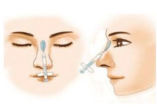 肖敬贞医生技术优势