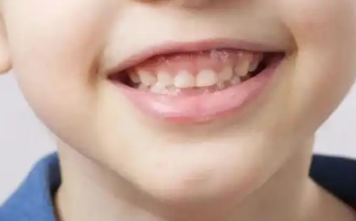 李从鑫医生技术优势