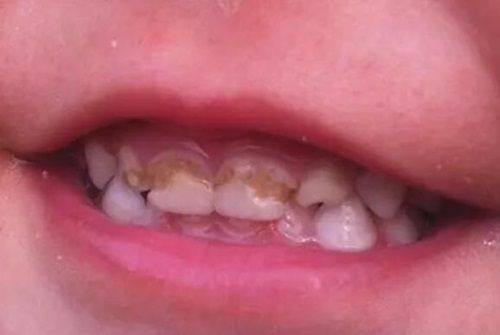 赵中华医生技术优势