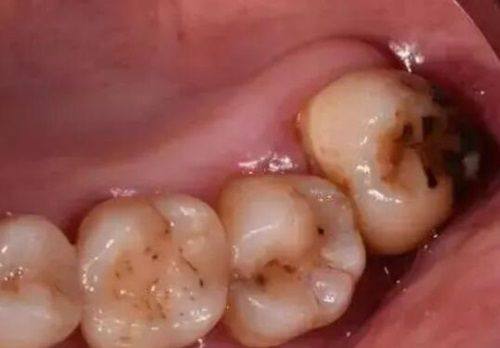 李从鑫医生技术优势