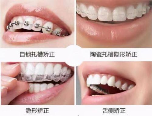 赵中华医生预约挂号