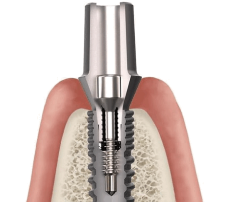 赵中华医生技术优势