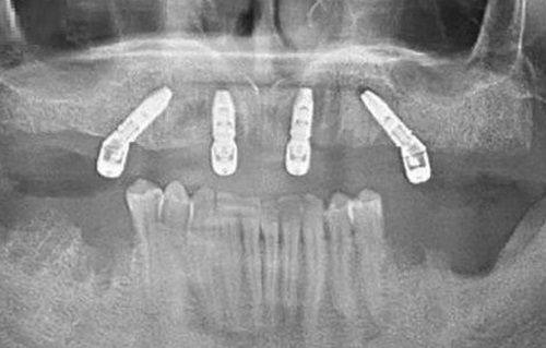 赵中华医生口碑评价及真人实例