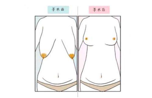 张克昶医生价格表