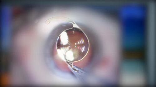 杨筱曦医生技术优势