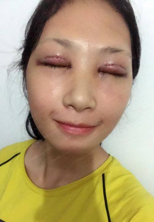 泰安臻美国内外整形美容医院是正规医院吗？