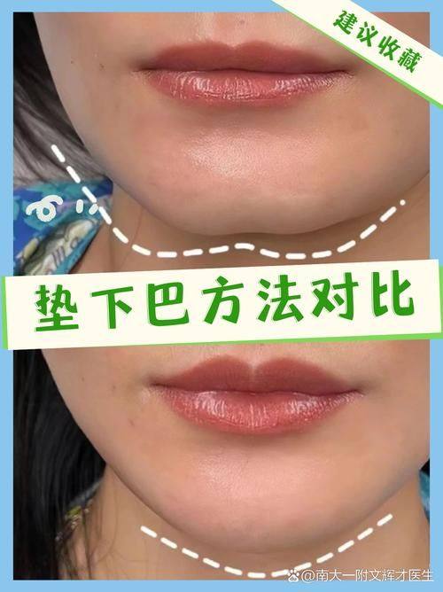 泰安臻美国内外整形美容医院真人口碑评价怎么样？