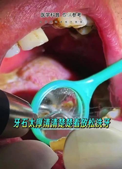 贵州德雅口腔诊所特色项目及技术优势