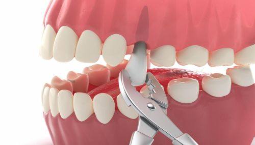 朔州颐美口腔医院详细的预约挂号方式及流程