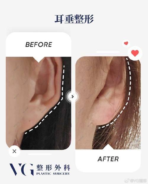 张克昶医生技术优势