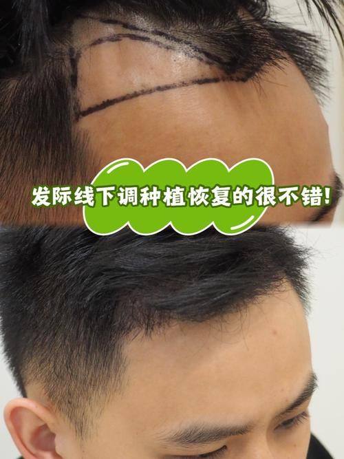 扬州时旭医疗美容门诊部是正规医院吗？