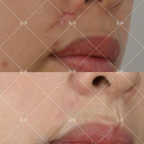 宁波市第二医院整形外科地址电话营业时间