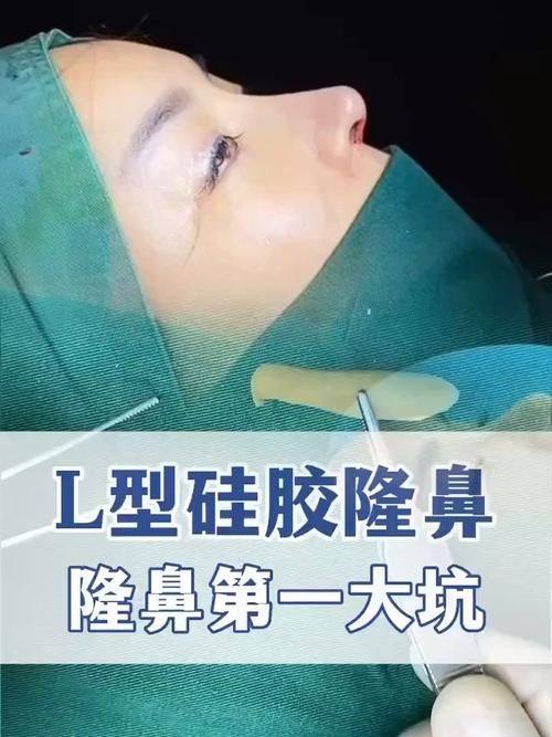 重庆小氧医疗美容诊所特色项目及技术优势