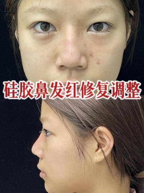 重庆小氧医疗美容诊所真人口碑评价怎么样？