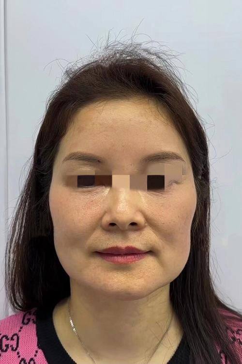 扬州时旭医疗美容门诊部收费价格表/收费标准